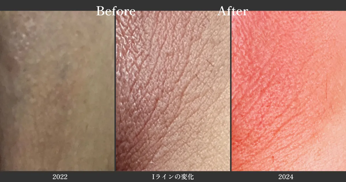 物理的リセットの証明