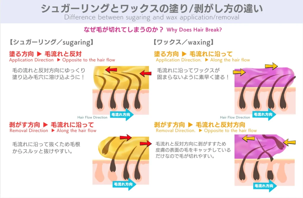 シュガーリングとワックスの違い